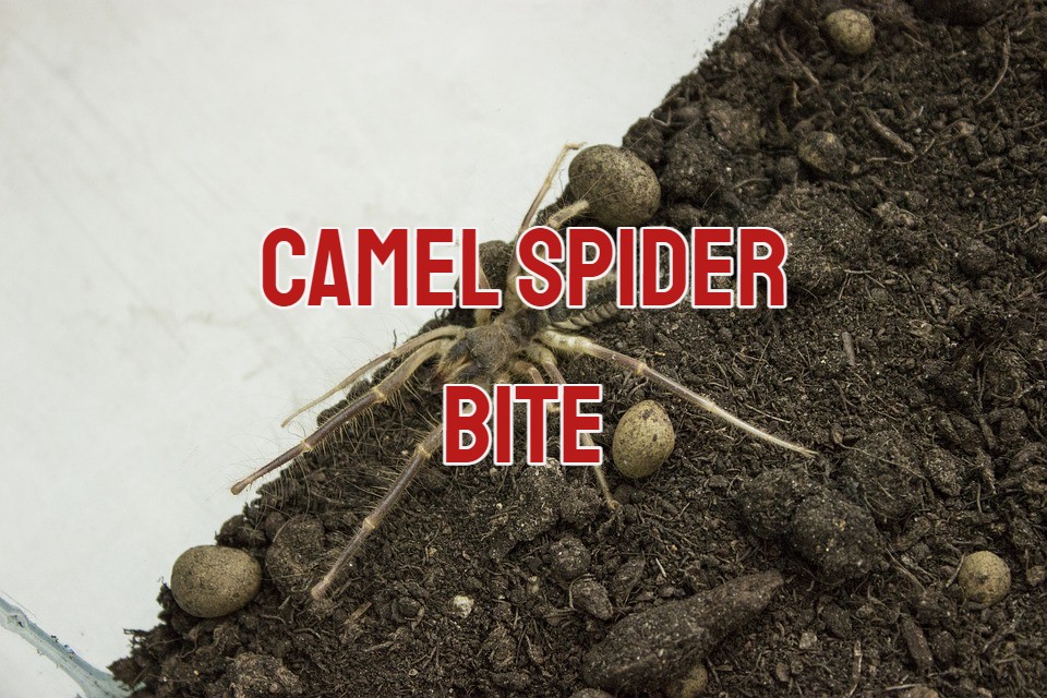 camel spider bite